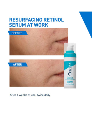 Cerave Resurfacing Retinol Serum 30Ml